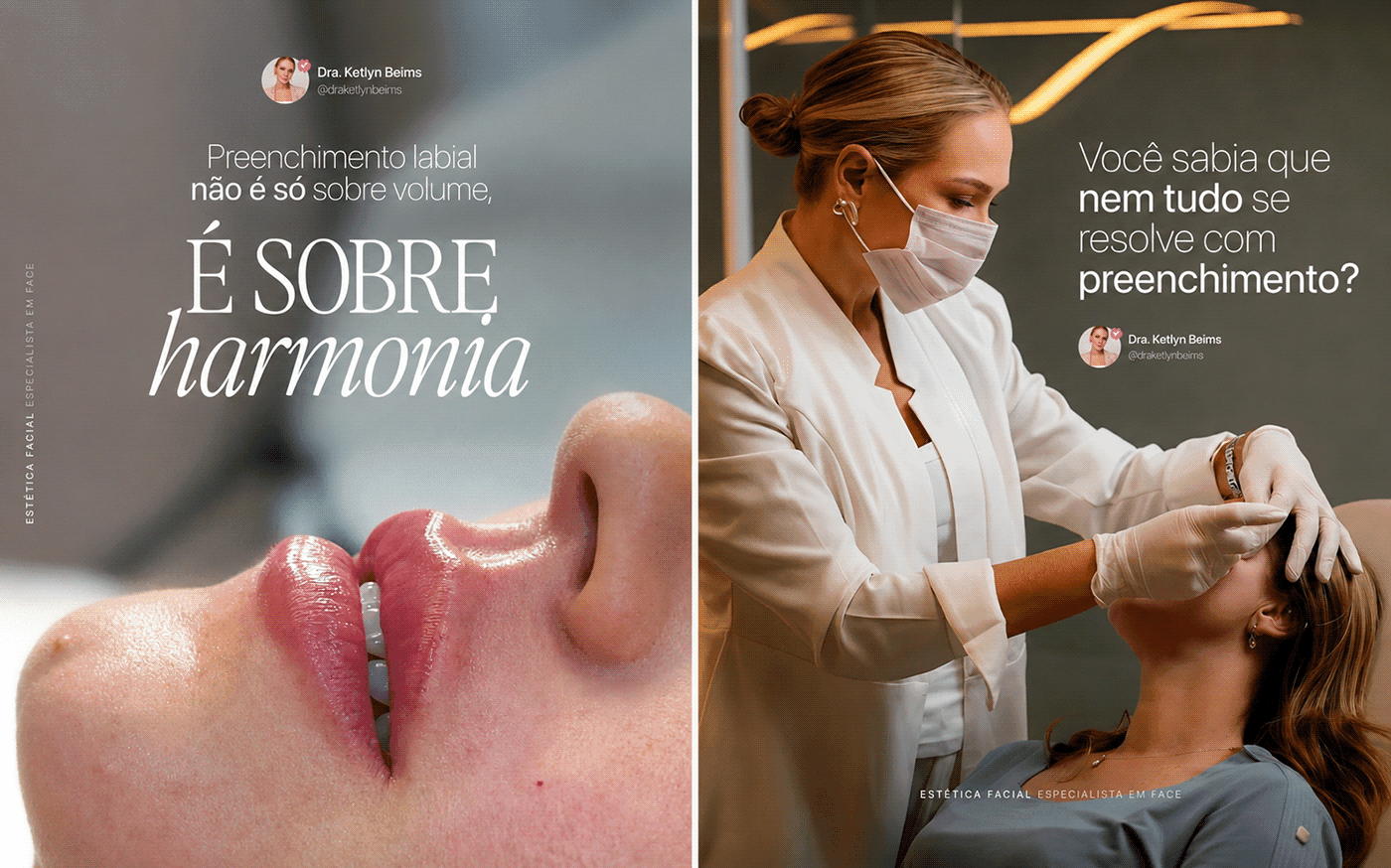 Capa do projeto POSTS SOCIAL MEDIA - ESTÉTICA